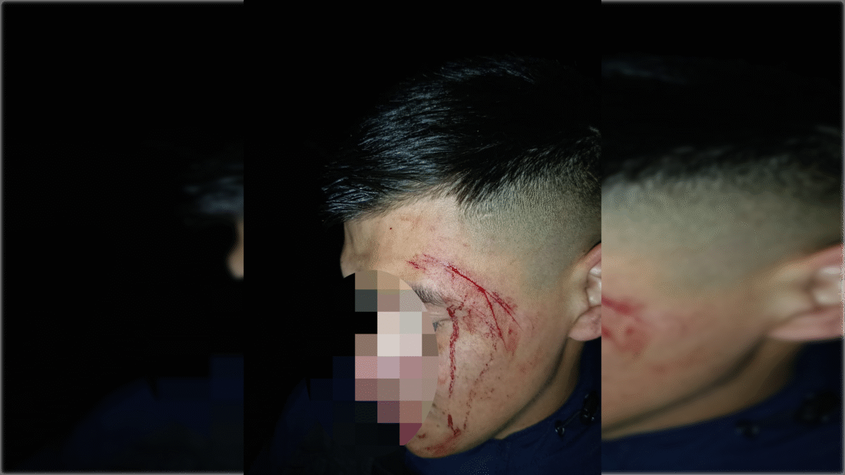 Policía fue atacado por la espalda cuando se dirigía a su guardia en el barrio 120 Viviendas